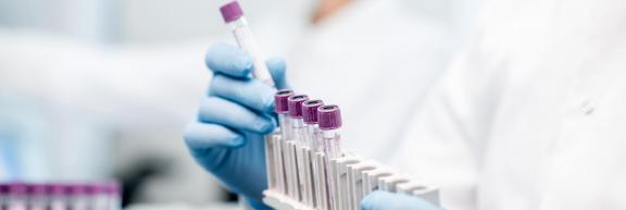 Priorisation des tests par RT-PCR - Covid 19